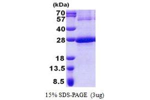 SDS-PAGE (SDS) image for NADH Dehydrogenase (Ubiquinone) 1 beta Subcomplex, 9, 22kDa (NDUFB9) (AA 1-179) protein (His tag) (ABIN5853175) (NDUFB9 Protein (AA 1-179) (His tag))