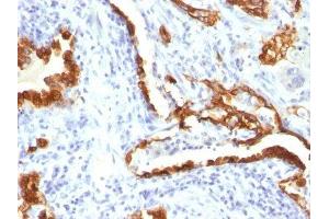 Image no. 3 for anti-Keratin 18 (KRT18) antibody (ABIN6179389) (Cytokeratin 18 抗体)