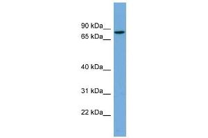 CRTAC1 antibody used at 1 ug/ml to detect target protein.