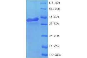 SDS-PAGE (SDS) image for Regulator of G-Protein Signaling 2 (RGS2) (AA 1-211), (full length) protein (His-SUMO Tag) (ABIN5710254)