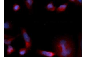 Immunofluorescence (IF) image for anti-Eukaryotic Translation Initiation Factor 1B (EIF1B) (AA 1-113) antibody (PE) (ABIN5567955) (EIF1B 抗体  (AA 1-113) (PE))