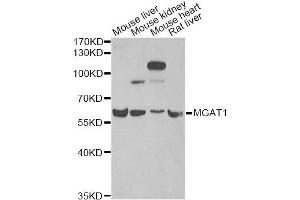 Western blot analysis of extracts of various cell lines, using MGAT1 antibody (ABIN2563858) at 1:1000 dilution. (MGAT1 抗体)