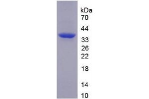 SDS-PAGE analysis of recombinant Human TNIP2 Protein. (TNIP2 蛋白)