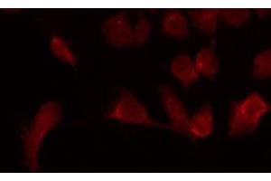 ABIN6275621 staining Hela by IF/ICC. (CD6 抗体  (Internal Region))