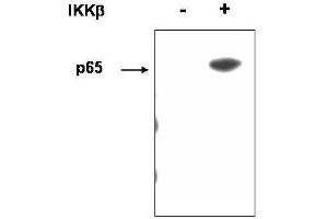 Western blot using  affinity purified anti-p65 (RelA) pS536 antibody shows detection of p65 phosphorylated at S536. (NF-kB p65 抗体  (pSer276))