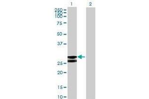 Lane 1: MGC50559 transfected lysate ( 29. (MGC50559 293T Cell Transient Overexpression Lysate(Denatured))