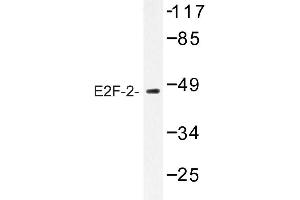Image no. 1 for anti-E2F Transcription Factor 2 (E2F2) antibody (ABIN272230) (E2F2 抗体)