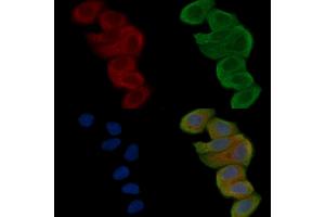 ABIN6262048 and ABIN6268844 staining Hela cells(30 min of UV treatment) by IF/ICC. (QRFPR 抗体  (Internal Region))