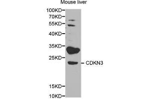 Western blot analysis of extracts of mouse liver, using CDKN3 antibody (ABIN5971092) at 1/1000 dilution. (CDKN3 抗体)