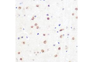 Immunohistochemistry (IHC) image for anti-Kruppel-Like Factor 4 (Gut) (KLF4) antibody (ABIN7268157)