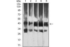 Western Blotting (WB) image for anti-Autophagy related 4B Cysteine Peptidase (ATG4B) (AA 1-221) antibody (ABIN7193464)
