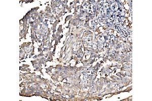 IHC analysis of HMGCS2 using anti-HMGCS2 antibody (ABIN7599435).
