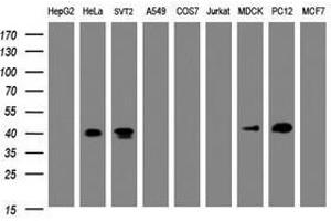 Image no. 1 for anti-NudE Nuclear Distribution E Homolog (A. Nidulans)-Like 1 (NDEL1) antibody (ABIN1499857) (NDEL1 抗体)