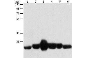 Western Blot analysis of Human fetal muscle and fetal lung tissue, Human leiomyosarcoma tissue, Mouse lung and heart tissue, NIH/3T3 cell using CAV1 Polyclonal Antibody at dilution of 1:550