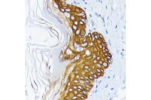 Immunohistochemistry of paraffin-embedded rat skin using Cytokeratin 14 (KRT14) (KRT14) Rabbit mAb (ABIN7268091) at dilution of 1:100 (40x lens). (KRT14 抗体)