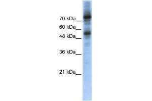 WB Suggested Anti-FOXM1 Antibody Titration:  0. (FOXM1 抗体  (Middle Region))