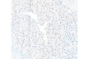 Immunohistochemistry (IHC) image for anti-Protein Phosphatase 4, Catalytic Subunit (PPP4C) (AA 1-50) antibody (ABIN7454679) (PPP4C 抗体  (AA 1-50))