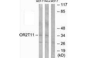 Western Blotting (WB) image for anti-Olfactory Receptor, Family 2, Subfamily T, Member 11 (OR2T11) (AA 51-100) antibody (ABIN2890927) (OR2T11 抗体  (AA 51-100))
