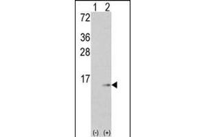 Western blot analysis of S100A6 (arrow) using rabbit polyclonal S100A6 Antibody (C-term) (ABIN391522 and ABIN2841482). (S100A6 抗体  (C-Term))