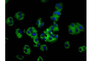 Immunofluorescence staining of HepG2 cells with ABIN7142134 at 1:100, counter-stained with DAPI. (MOGAT1 抗体  (AA 163-246))