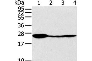 Western Blot analysis of Raji, 231, 293T and A549 cell using TPD52 Polyclonal Antibody at dilution of 1:320 (TPD52 抗体)