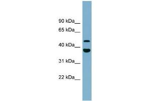 WB Suggested Anti-C4orf20 Antibody Titration: 0. (UFSP2 抗体  (Middle Region))