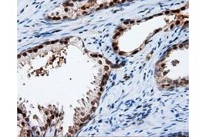 Immunohistochemistry (IHC) image for anti-Amyloid beta (A4) Precursor Protein (APP) antibody (ABIN1496880) (APP 抗体)
