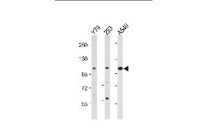 All lanes : Anti-hNEK4- at 1:2000 dilution Lane 1: Y79 whole cell lysate Lane 2: 293 whole cell lysate Lane 3: A549 whole cell lysate Lysates/proteins at 20 μg per lane. (NEK4 抗体  (C-Term))