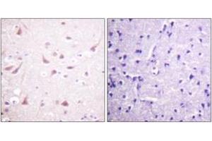 Immunohistochemistry analysis of paraffin-embedded human brain tissue, using DRP-2 (Ab-514) Antibody. (DRP2 抗体  (AA 480-529))