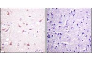 Immunohistochemistry analysis of paraffin-embedded human brain tissue, using DRP-2 (Ab-514) Antibody. (DRP2 抗体  (AA 480-529))