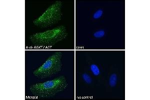 ABIN570702 Immunofluorescence analysis of paraformaldehyde fixed HeLa cells, permeabilized with 0. (AGXT 抗体  (Internal Region))