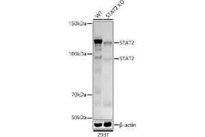 Western blot analysis of extracts from wild type(WT) and ST knockdown (KD) 293T cells, using ST antibody (ABIN1678782, ABIN3017845, ABIN3017846 and ABIN7101526) at 1:1000 dilution. (STAT2 抗体)