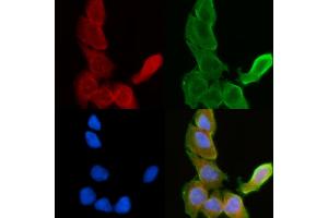 ABIN6262953 and ABIN6278151 staining Hela cells(30 min of UV treatment) by IF/ICC.