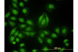 Immunofluorescence of monoclonal antibody to TYK2 on HeLa cell. (TYK2 抗体  (AA 276-375))