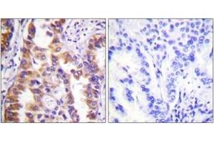 Immunohistochemistry (IHC) image for anti-Tuberous Sclerosis 2 (TSC2) (AA 905-954) antibody (ABIN2888710) (Tuberin 抗体  (AA 905-954))