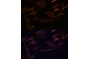 Immunofluorescence analysis of C6 cells using RPL7A antibody (ABIN6128658, ABIN6147151, ABIN6147153 and ABIN6218286) at dilution of 1:100. (RPL7A 抗体  (AA 1-266))