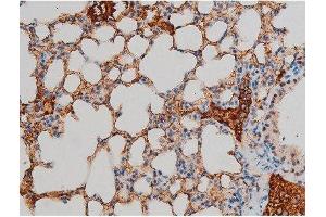ABIN6267395 at 1/200 staining Mouse lung tissue sections by IHC-P.