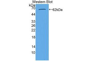 Western blot analysis of the recombinant protein. (Acylglycerol Kinase 抗体  (AA 15-300))