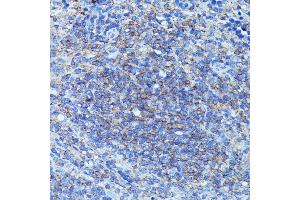 Immunohistochemistry of paraffin-embedded mouse spleen using CSF3 antibody (ABIN6127710, ABIN6139100, ABIN6139101 and ABIN6221772) at dilution of 1:100 (40x lens). (G-CSF 抗体  (AA 30-207))