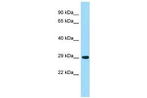 WB Suggested Anti-ACER2 Antibody Titration: 1. (ACER2 抗体  (Middle Region))