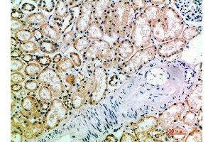 Immunohistochemical analysis of paraffin-embedded human-kidney, antibody was diluted at 1:200 (KIR3DL2 抗体  (AA 221-270))