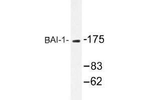 Image no. 1 for anti-Brain-Specific Angiogenesis Inhibitor 1 (BAI1) antibody (ABIN317742)