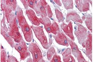 Immunohistochemistry (Formalin-fixed Paraffin-embedded Sections) (IHC (fp)) image for anti-ATPase, Ca++ Transporting, Cardiac Muscle, Fast Twitch 1 (ATP2A1) (AA 522-613) antibody (ABIN574210)