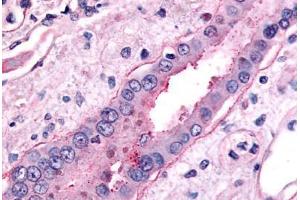 Immunohistochemistry (IHC) image for anti-Solute Carrier Family 5 (Sodium/glucose Cotransporter), Member 2 (SLC5A2) (C-Term) antibody (ABIN1049344)