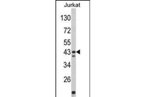 Western blot analysis of CECR5 Antibody (Center) (ABIN652500 and ABIN2842336) in Jurkat cell line lysates (35 μg/lane). (CECR5 抗体  (AA 164-190))