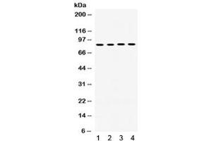Western Blotting (WB) image for anti-P450 (Cytochrome) Oxidoreductase (POR) antibody (ABIN4952222)