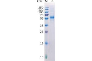 Human  LAG3 Protein, His Tag on SDS-PAGE under reducing condition. (LAG3 Protein (His tag))