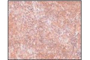 Immunohistochemistry of JMJD8 in mouse spleen tissue with this product at 2. (JMJD8 抗体  (C-Term))