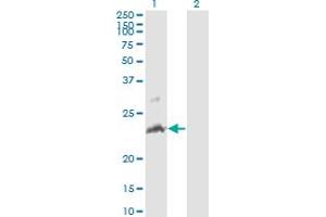 Western Blot analysis of TNFSF14 expression in transfected 293T cell line by TNFSF14 monoclonal antibody (M01A), clone 4E3. (TNFSF14 抗体  (AA 61-170))