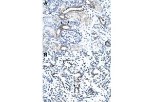 Immunohistochemical staining (Formalin-fixed paraffin-embedded sections) of human kidney (A) and human lung (B) with EVX1 polyclonal antibody  at 4-8 ug/mL working concentration. (EVX1 抗体  (N-Term))